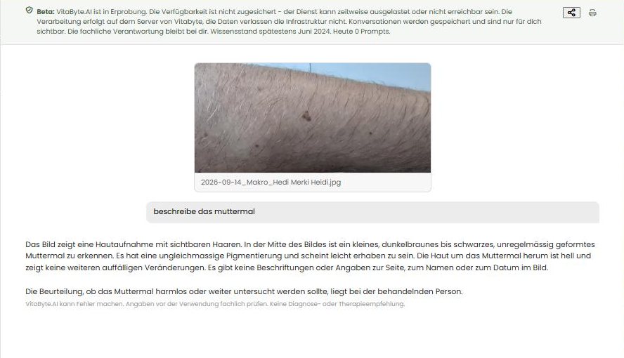 VitaByte.AI beschreibt das Foto eines Muttermals